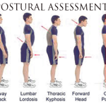 posturalassessment