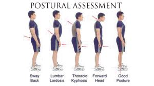 Postural Assessment ( Visual Observation )