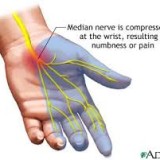 Carpal Tunnel Massage