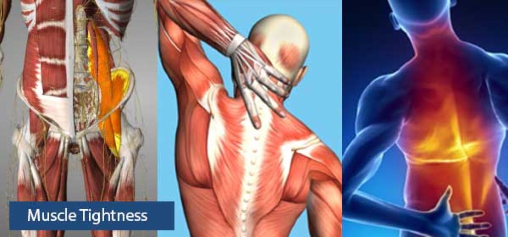 What Causes Chronic Muscle Tightness