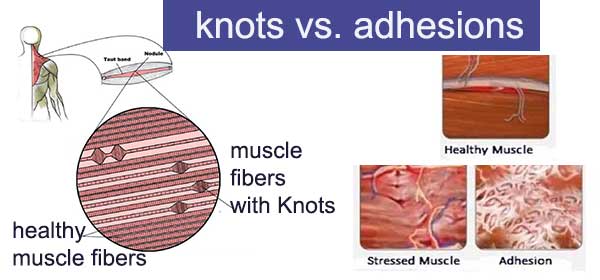 adhesion vs knots