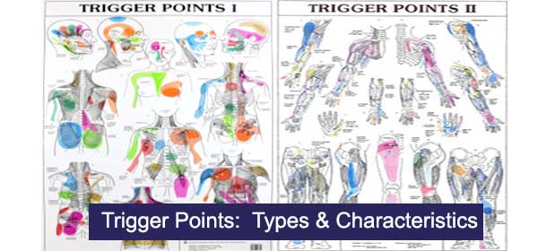 trigger point characteristics and types